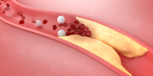 Colesterol: Todo lo que necesitas saber